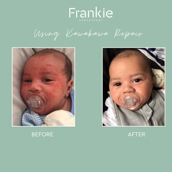 Frankie Kawakawa Repair Balm 105ml