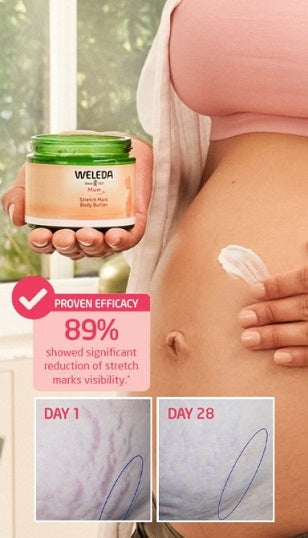 Weleda Mum Stretch Mark Body Butter 150ml